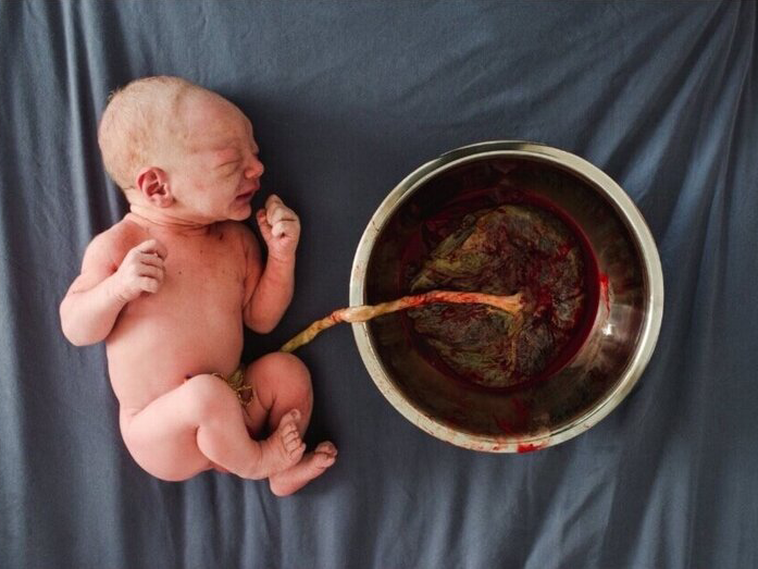 Newborn lays next to bowl with placenta