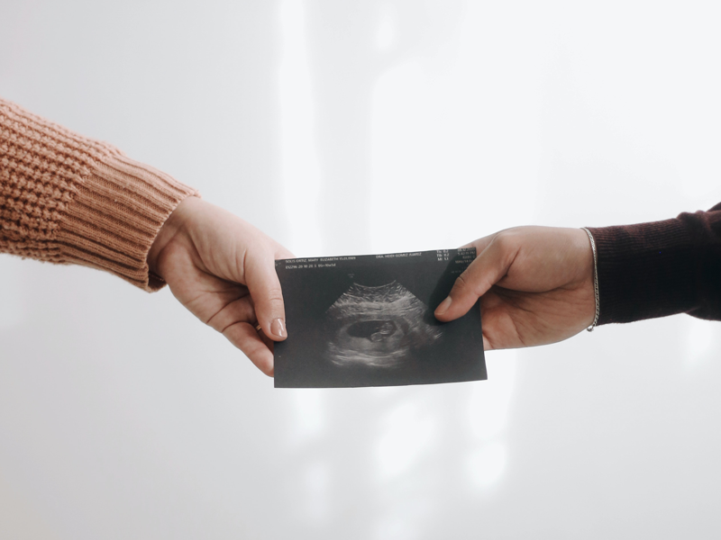 Parents hold sonogram